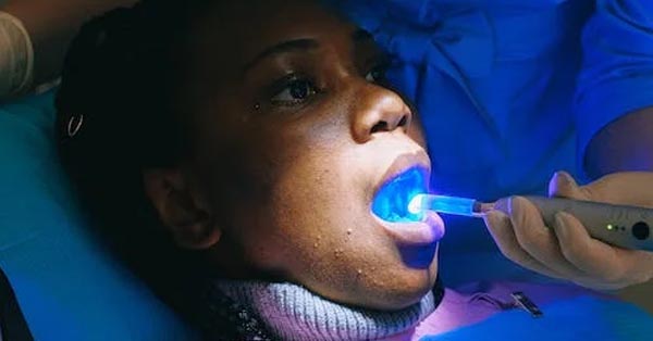 Choosing the Right Professional Teeth Whitening Treatment