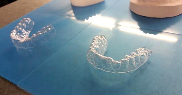 College Student Made His Own Braces For $60, And His Teeth Look Fantastic