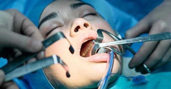 What Is Oral Surgery and How Is It Used?