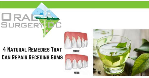 These 4 Natural Remedies Will Repair Receding Gums